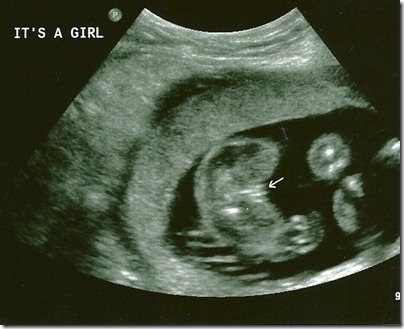 Sweet Pea Its a Girl