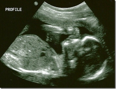 Sweet Pea Profile